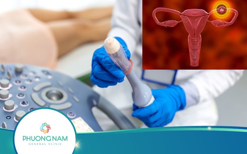 Liệu Siêu Âm Đầu Dò Có Phát Hiện Thai Ngoài Tử Cung Không?