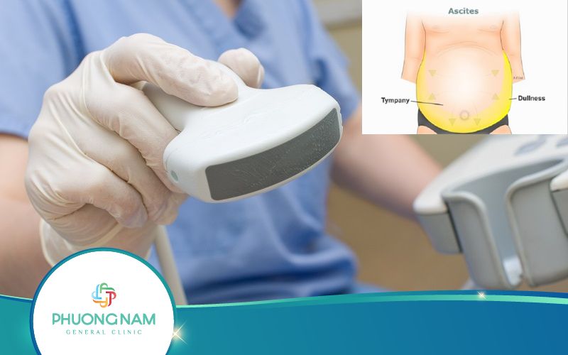 Siêu Âm Dịch Ổ Bụng Có Vai Trò Gì? Đánh Giá Thế Nào?