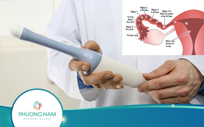 Liệu Thai Chưa Vào Tử Cung Siêu Âm Đầu Dò Có Thấy Không?