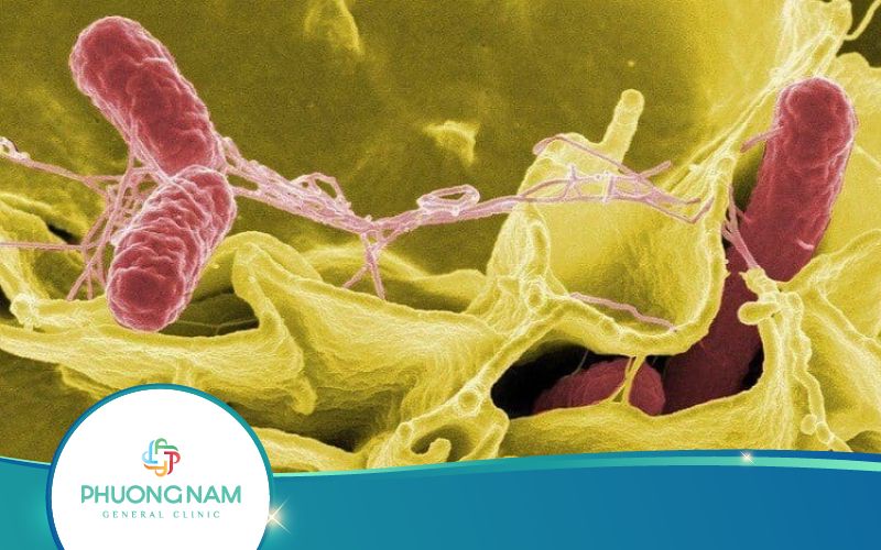 Những Thông Tin Chuẩn Xác Về Vi Khuẩn Thương Hàn Cần Biết