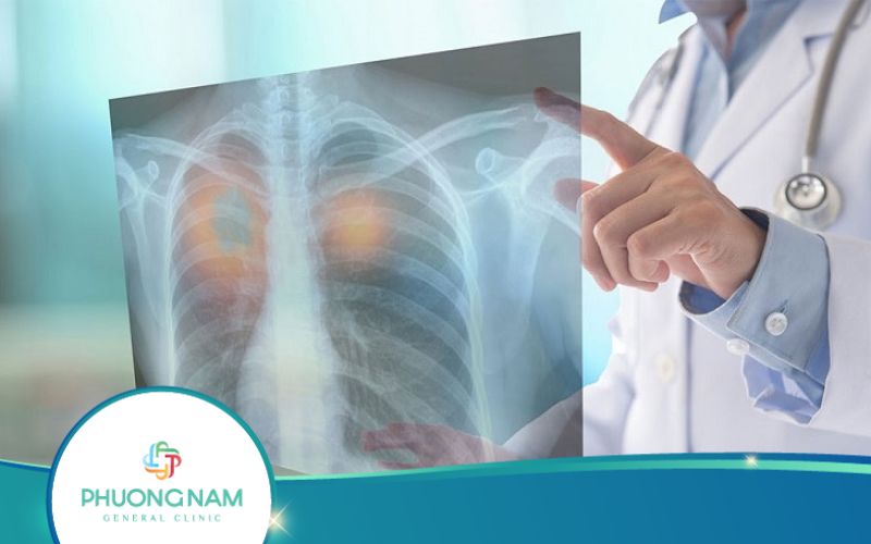Chụp X Quang Có Cần Cởi Quần Áo Không?