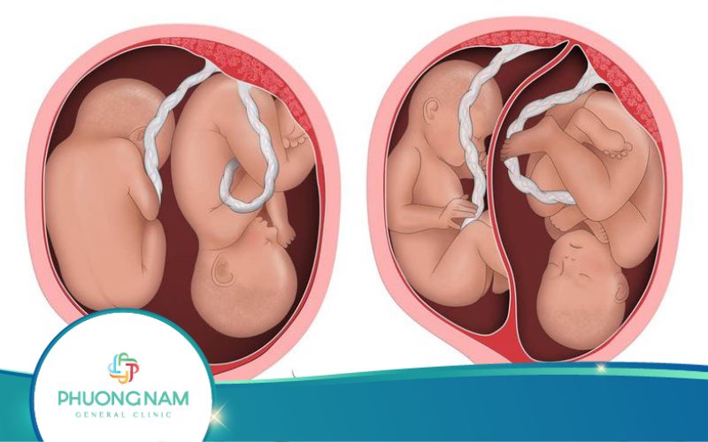 Hình Ảnh Siêu Âm Thai Đôi Qua Các Tuần Quan Trọng