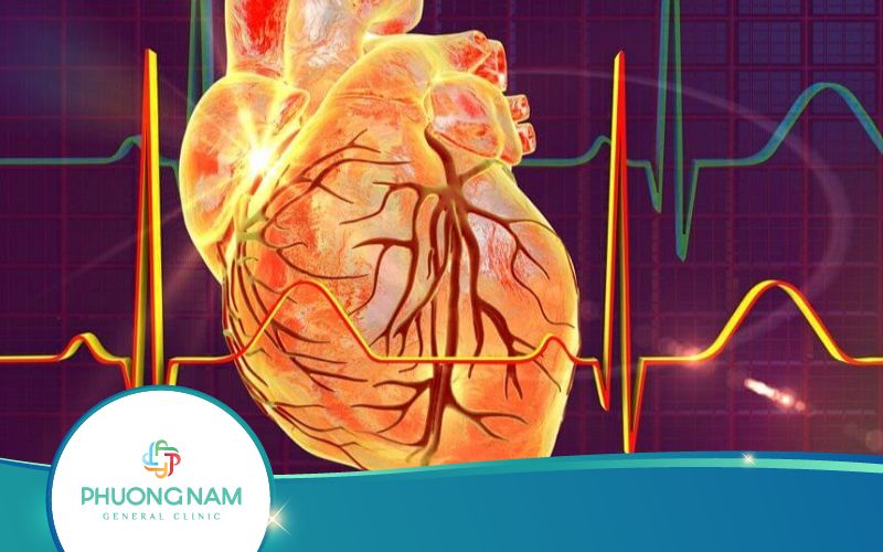 Siêu Âm Tim Có Phát Hiện Bệnh Mạch Vành Hay Không?