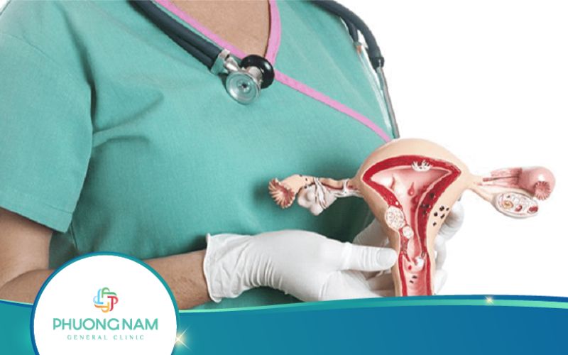 Cắt Tử Cung Nội Soi Được Chỉ Định Khi Nào?