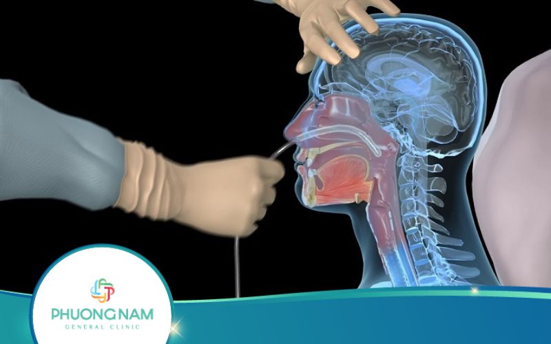 Nội Soi Dạ Dày Bao Nhiêu Tiền? Quy Trình Thực Hiện Ra Sao?