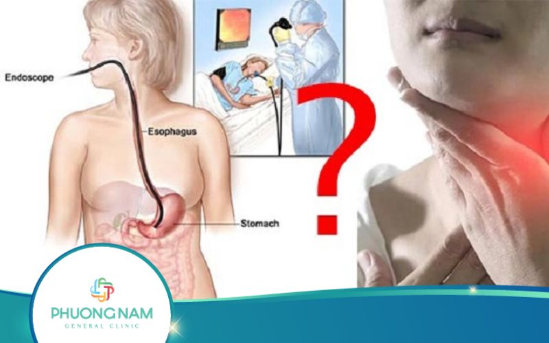 Nội Soi Dạ Dày Có Đau Không?