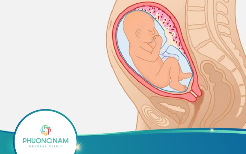 Thai Nhi 28 Tuần Tuổi Đạp Như Thế Nào?