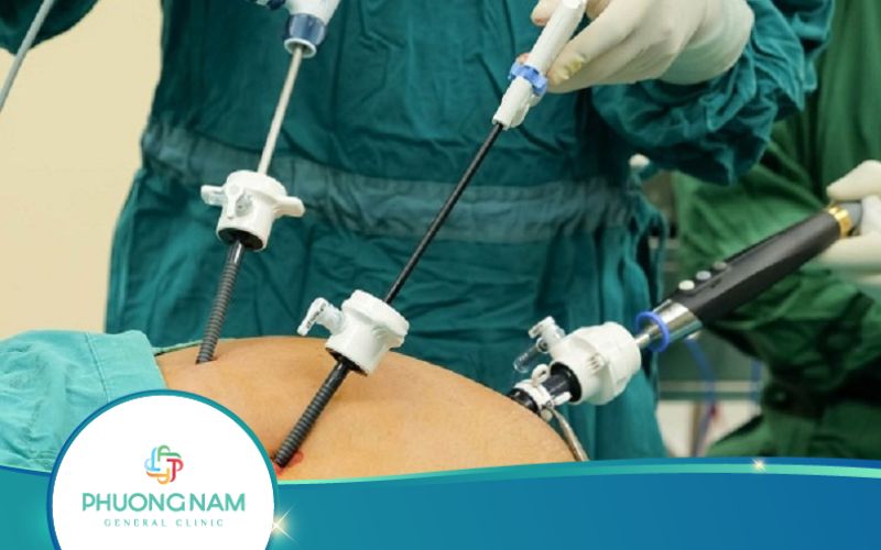 Sau Khi Mổ Nội Soi Kiêng Ăn Gì Để Nhanh Chóng Hồi Phục?