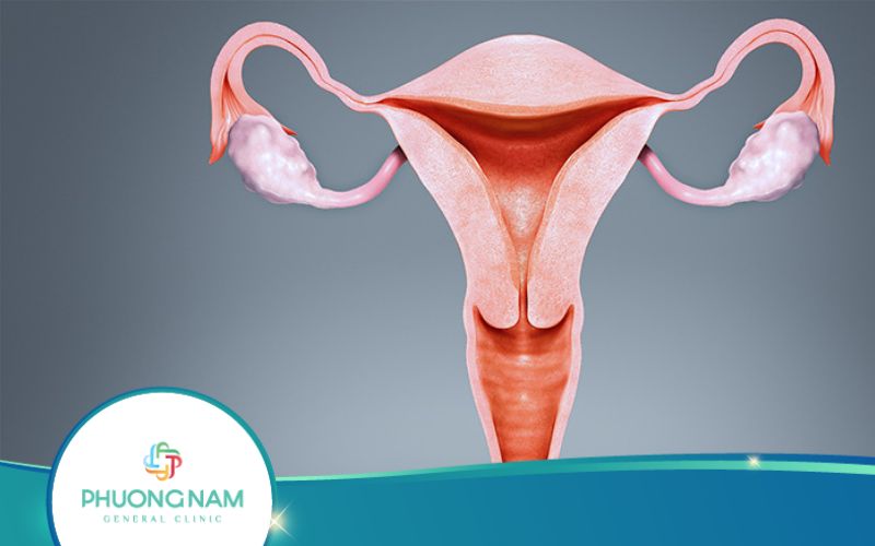 Mổ Nội Soi Thông Tắc Vòi Trứng Hết Bao Nhiêu Tiền?