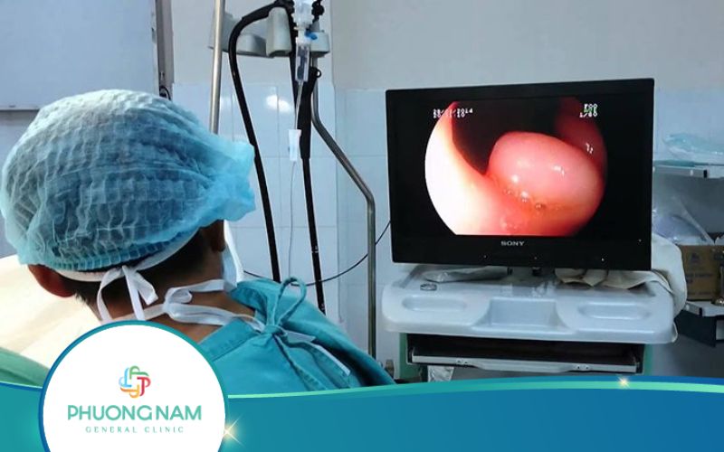 Các Phương Pháp Nội Soi Ruột Non Hiện Nay