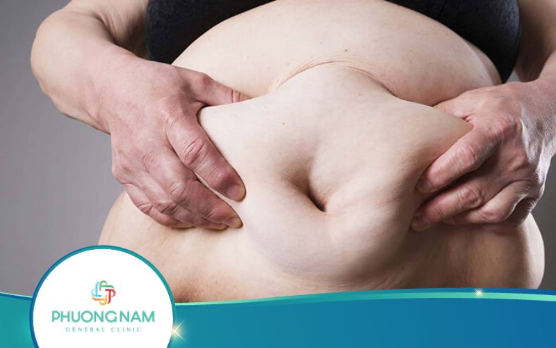 10 Cách Giúp Giảm 5Kg Trong 2 Tuần Cực Dễ