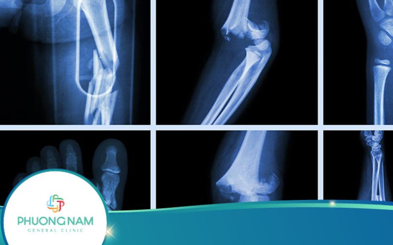 Dịch vụ Chụp X Quang Đức Trọng – Nhanh chóng, chính xác, an toàn!