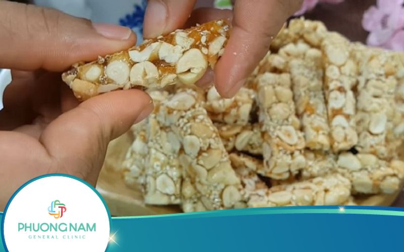 Kẹo Lạc Bao Nhiêu Calo? Ăn Kẹo Lạc Có Béo Không?