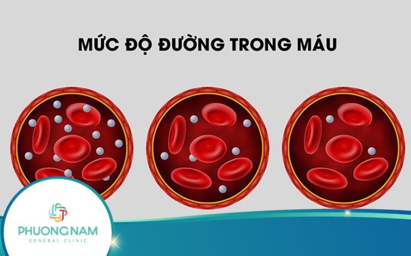5 Thực Phẩm Giúp Giảm Lượng Đường Trong Máu