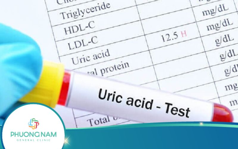 5 Thực Phẩm Giúp Giảm Nồng Độ Acid Uric