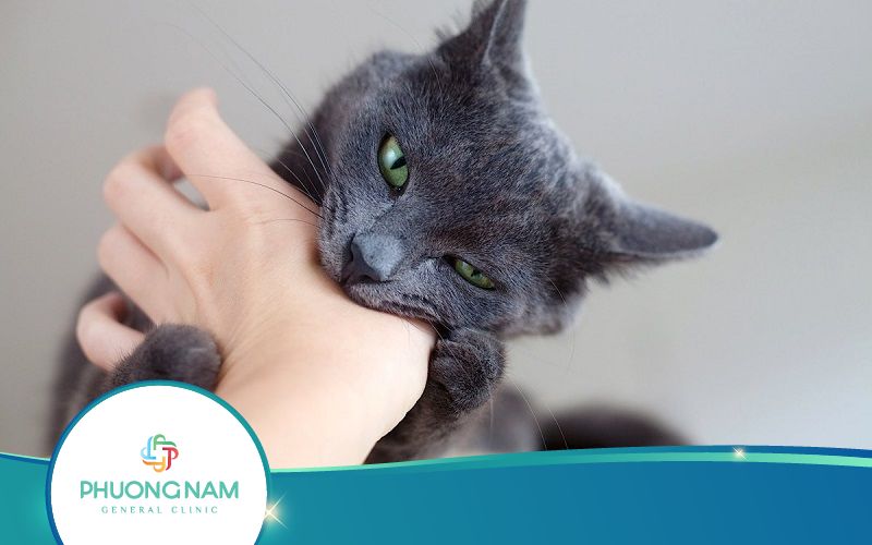 Bị Mèo Cào Có Nên Tiêm Phòng Dại Không? Địa Chỉ Tiêm Uy Tín