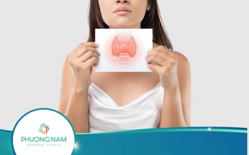Biểu Hiện Có Nhân Tuyến Giáp – Nguyên Nhân Và Cách Điều Trị