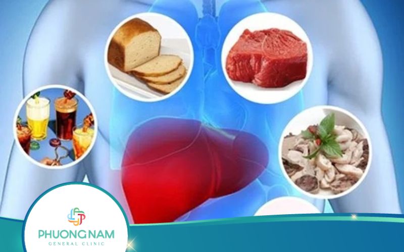 5 Loại Thực Phẩm Có Hại Cho Gan