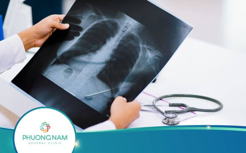 Bệnh Phổi Trắng Là Gì? Có Nguy Hiểm Không?