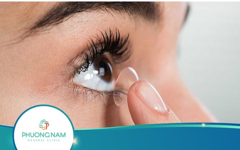 Các Phương Pháp Điều Trị Cận Thị Phổ Biến Nhất Hiện Nay
