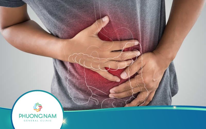 Giải Pháp Hạn Chế Hội Chứng Ruột Kích Thích