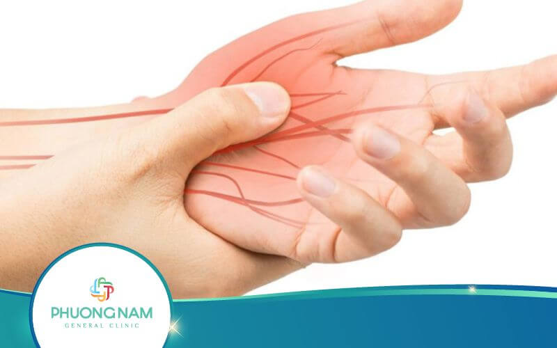 Biểu Hiện Của Hạ Canxi Máu – Nguyên Nhân, Cách Phòng Ngừa