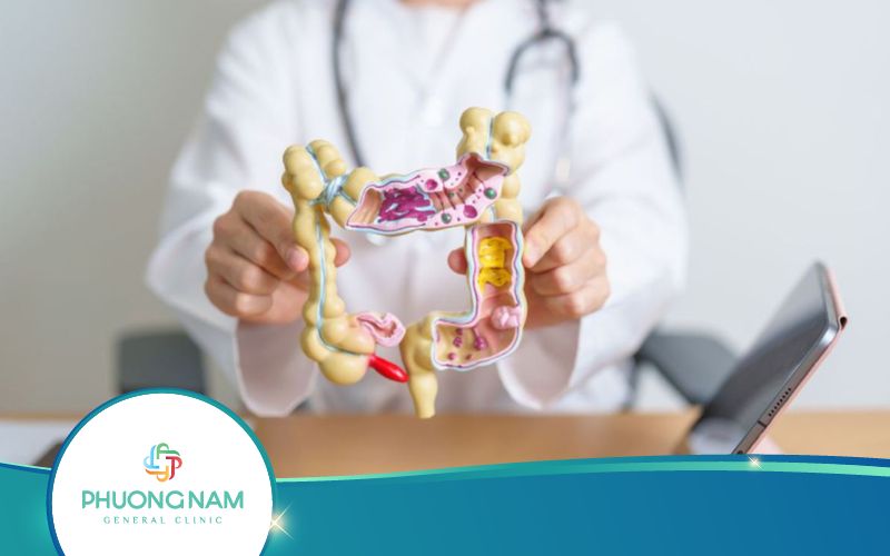Hội Chứng Ruột Kích Thích Có Nguy Hiểm Không?