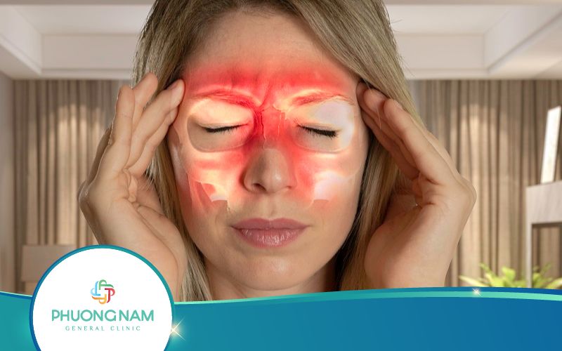 Viêm Đa Xoang – Nguyên Nhân và Phương Pháp Điều Trị