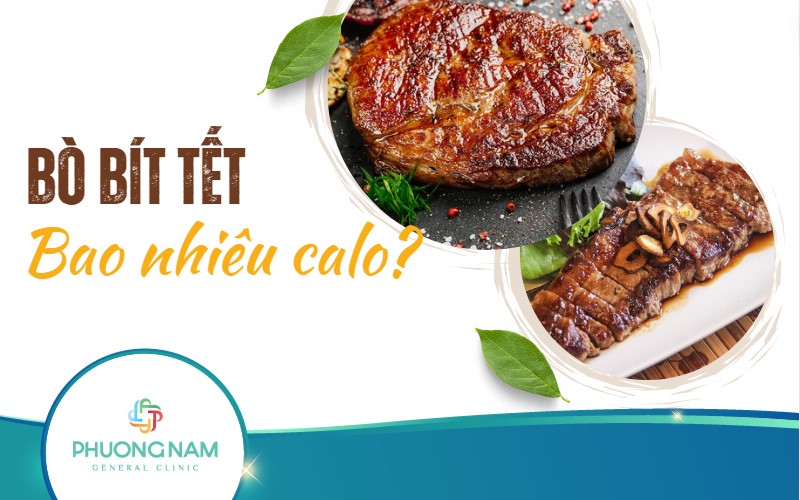 Bò bít tết bao nhiêu calo? Ăn bò bít tết có béo không?