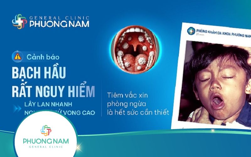 Bệnh bạch hầu nguy hiểm như thế nào? Cách phòng tránh hiệu quả nhất