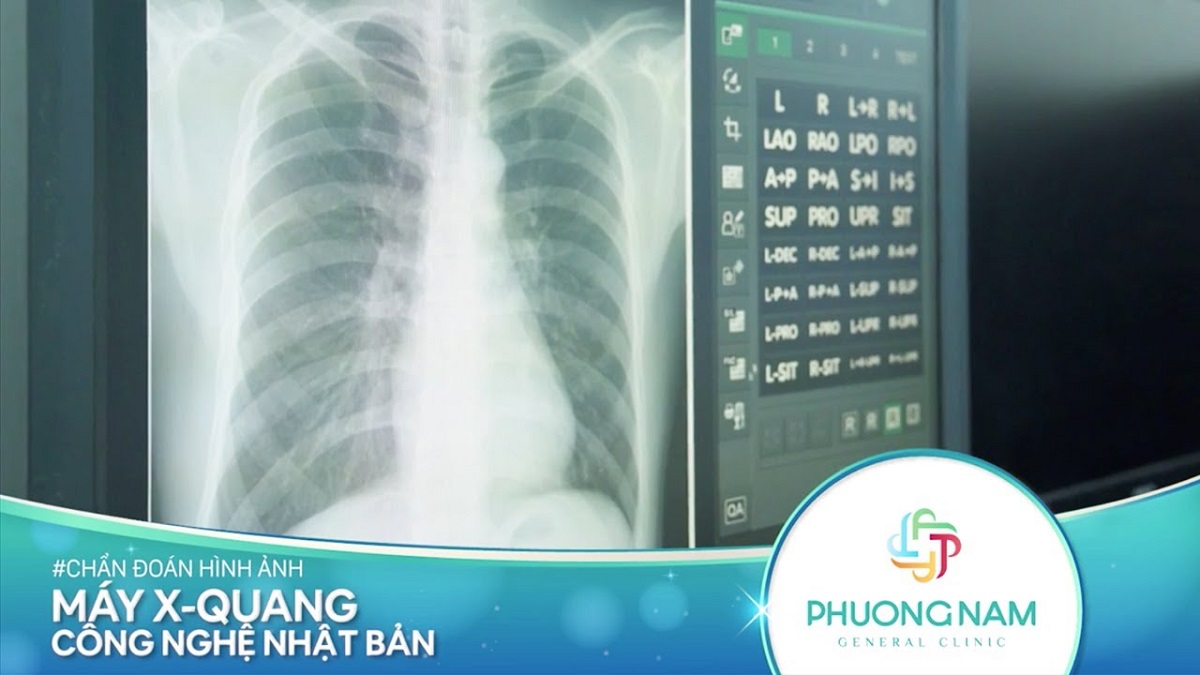 Trung Tâm Y Khoa Phương Nam: Máy X – Quang kỹ thuật số cao tần GXR – 40S