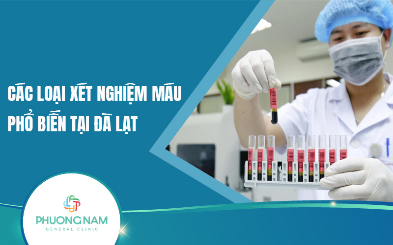 Các loại xét nghiệm máu phổ biến tại Đà Lạt. Lưu ý khi thực hiện xét nghiệm máu