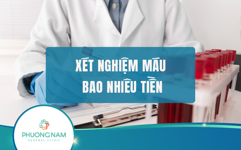 Xét nghiệm máu tại Đà Lạt bao nhiêu tiền? Trước khi xét nghiệm máu cần lưu ý điều gì?