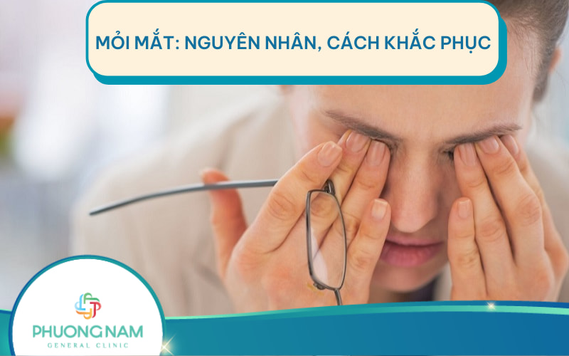 Mỏi mắt: Nguyên nhân, chẩn đoán, điều trị và phòng ngừa