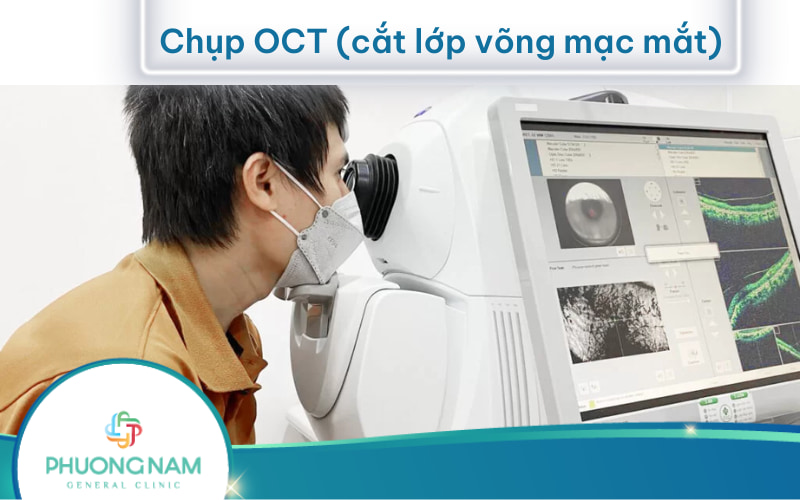 Chụp OCT – Chụp cắt lớp võng mạc chẩn đoán bệnh lý mắt
