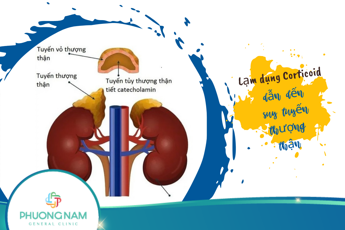 Lạm dụng Corticoid là nguyên nhân dẫn đến suy tuyến thượng thận