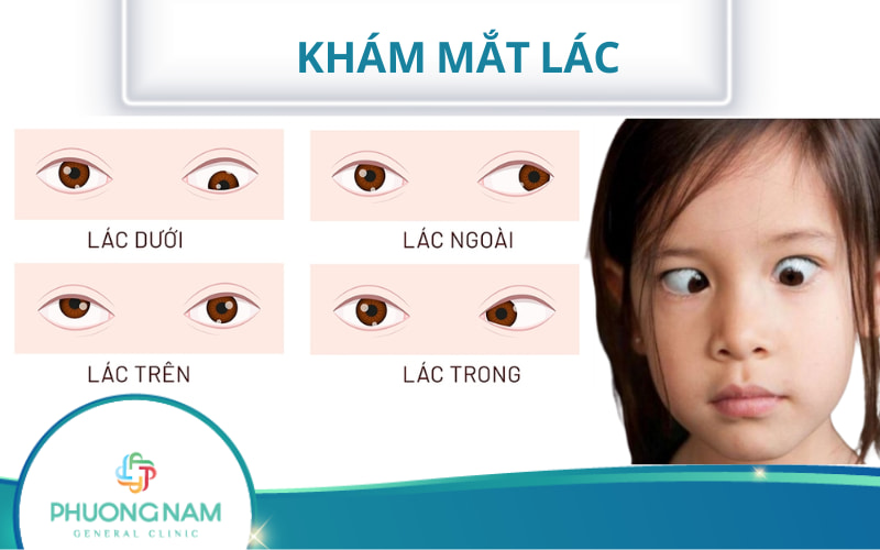 4 phương pháp khám lác mắt phổ biến hiện nay