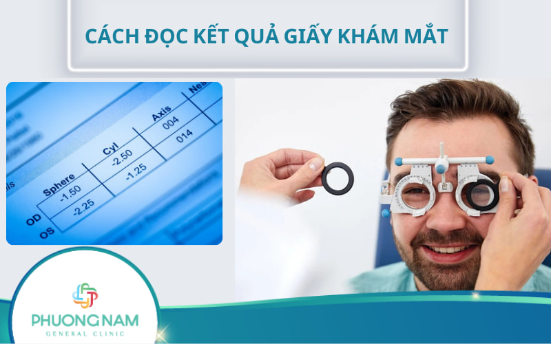 Cách đọc kết quả giấy khám mắt chính xác, nhanh chóng