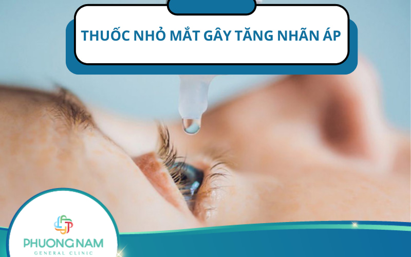 Cảnh báo thuốc nhỏ mắt gây tăng nhãn áp thường gặp