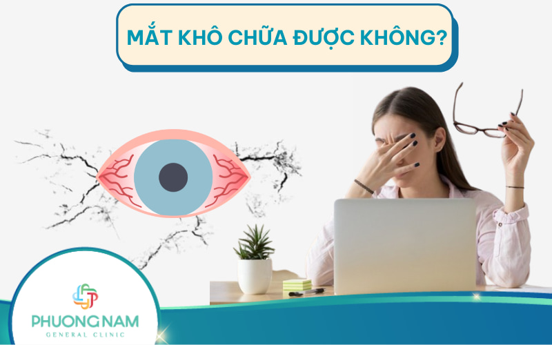 Bệnh khô mắt có chữa được không? Và được điều trị như thế nào?