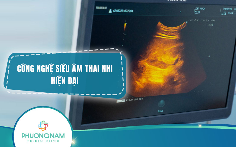 Những công nghệ siêu âm thai nhi hiện đại nhất hiện nay