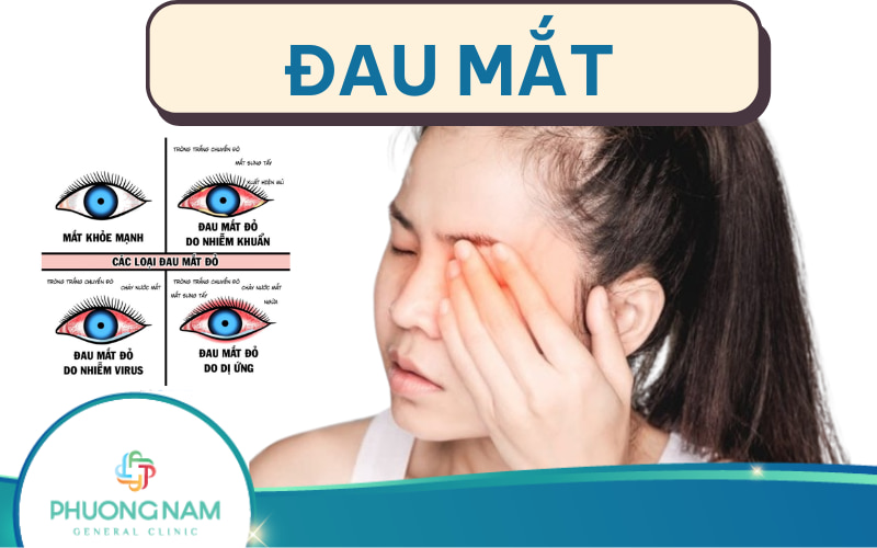 Đau mắt: Nguyên nhân, triệu chứng và lưu ý cần nắm