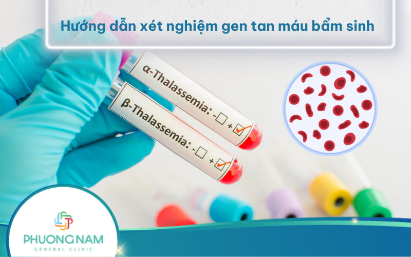 Hướng dẫn xét nghiệm gen tan máu bẩm sinh (thalassemia) chi tiết