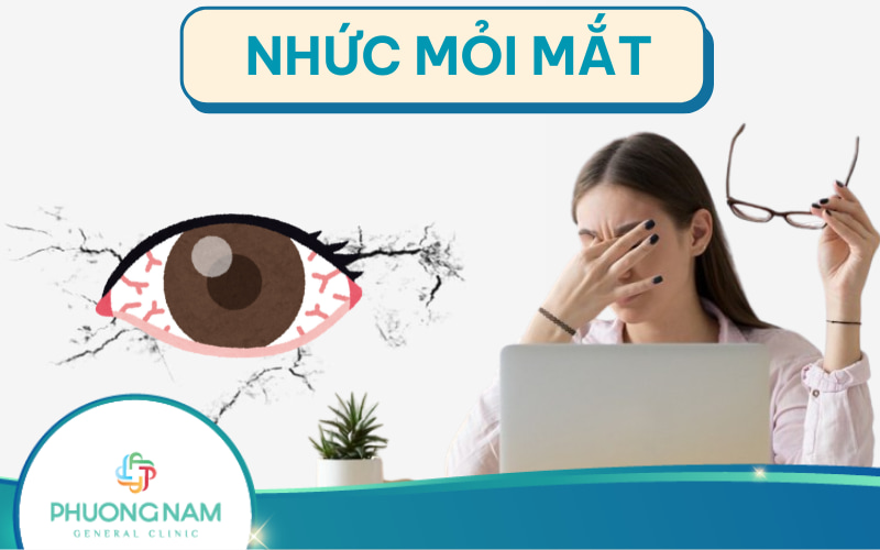 Mắt nhức mỏi: Nguyên nhân, triệu chứng và cách phòng ngừa