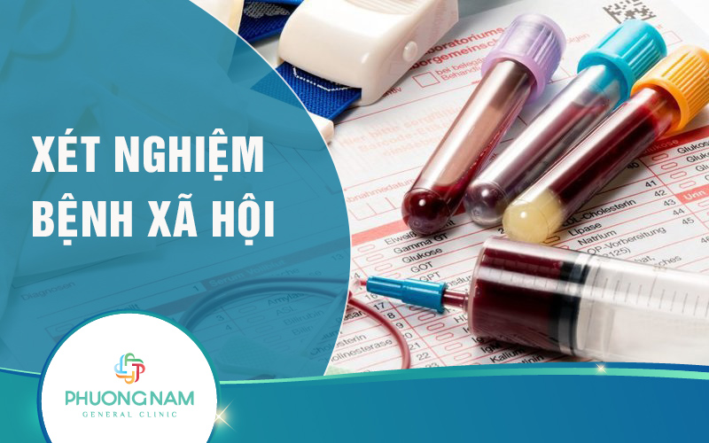 Xét nghiệm bệnh xã hội – Đảm bảo sức khỏe, gia đình yên vui