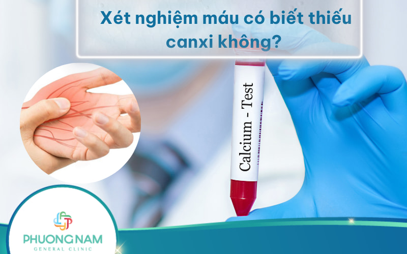 Xét nghiệm máu có biết thiếu canxi không? Và Ý nghĩa kết quả xét nghiệm canxi máu