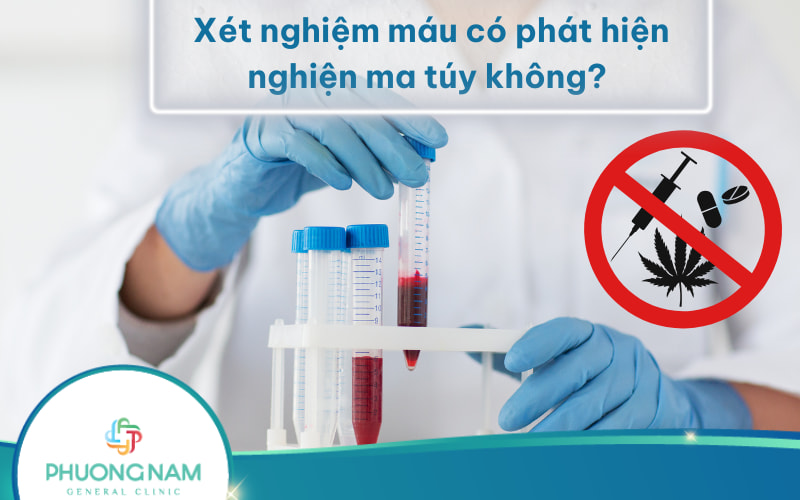 Xét nghiệm máu có phát hiện nghiện ma túy không? Và có phát hiện những chất gây không?