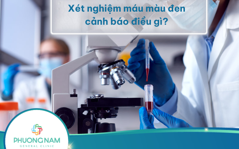 Xét nghiệm máu màu đen cảnh báo điều gì? Và Biện pháp phòng tránh bệnh lý máu màu đen