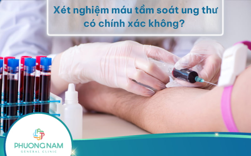 Xét nghiệm máu tầm soát ung thư có chính xác không? Có thể phát hiện những loại ung thư nào?