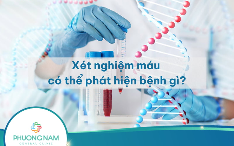 Giải đáp: Xét nghiệm máu tổng quát biết được những bệnh gì?